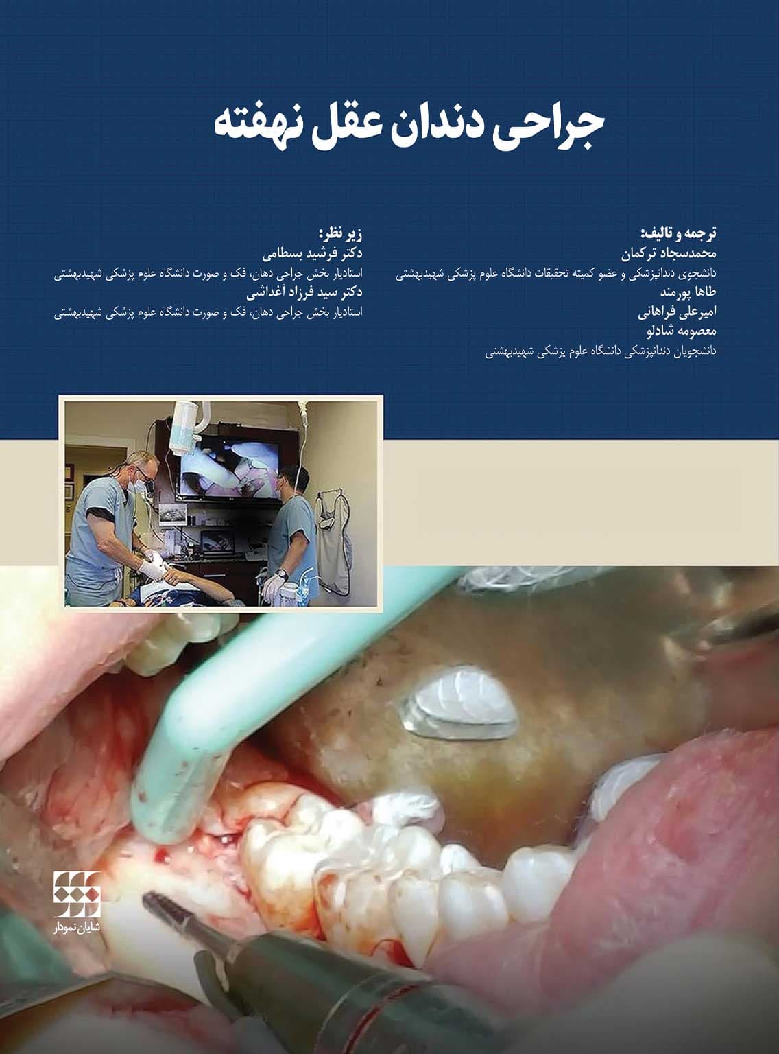 جراحی دندان عقل نهفته شایان نمودار