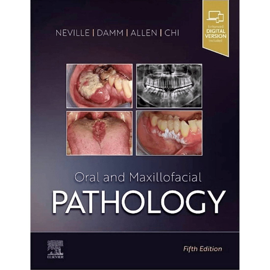 Oral and Maxillofacial Pathology 5th Edition (NEVILLE) 2024