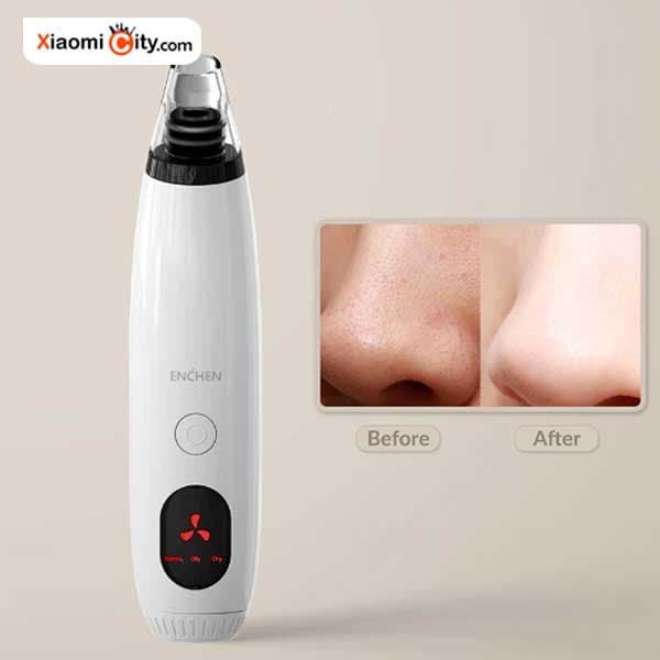 دستگاه پاکسازی صورت Enchen مدل EB1001 — تصویر ۳