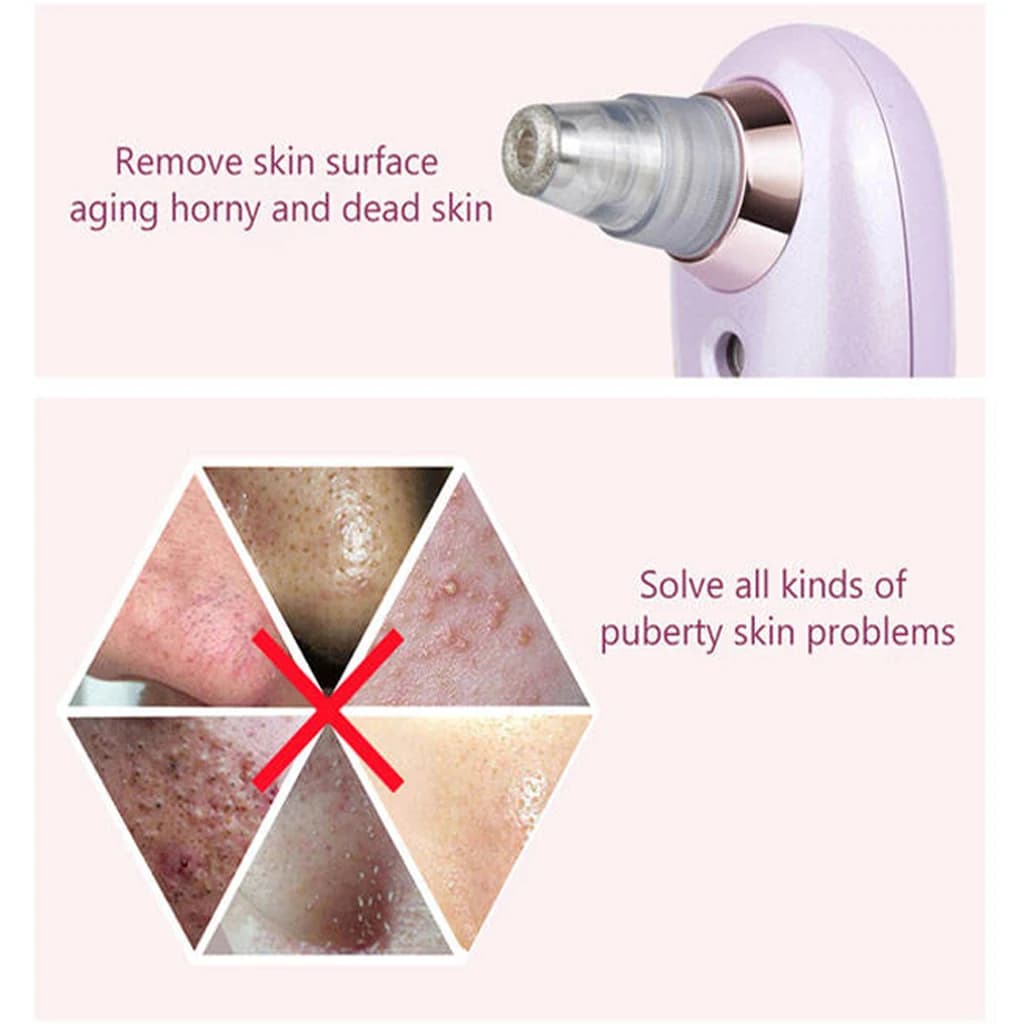 دستگاه میکرودرم باراباس نانو | Barabasnano Electric Blackhead Remover — تصویر ۹