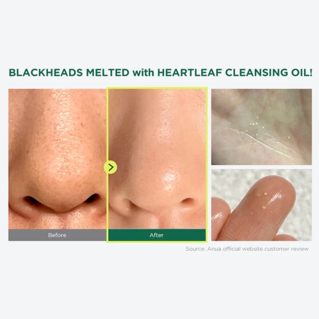 روغن پاک کننده آرایش آنوا مدل Anua Heartleaf Pore Control Cleansing Oil — تصویر ۸