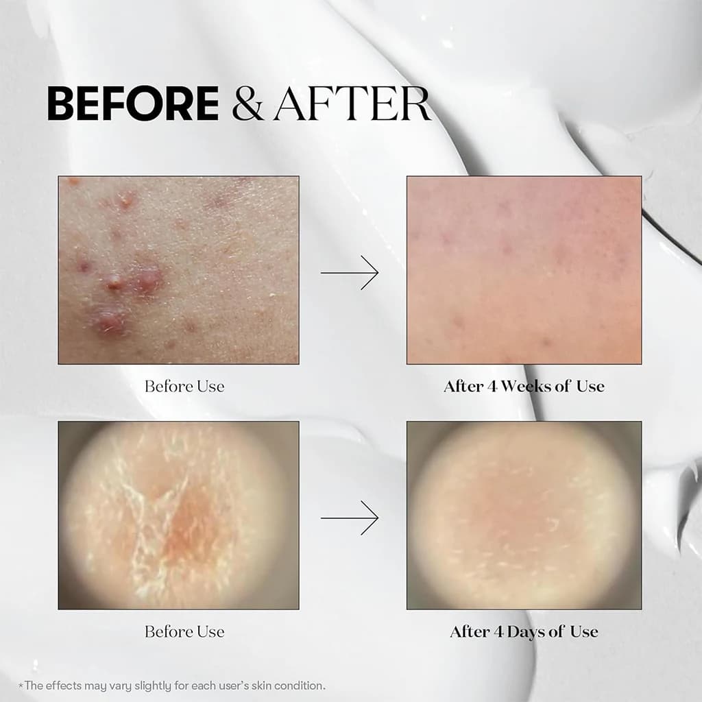 سرم ریدل شات ۱۰۰ وی تی کازمتیک | VT Cosmetics Reedle Shot 100 — تصویر ۴