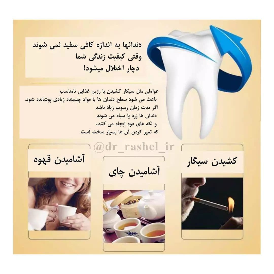 خمیر دندان سفیدکننده طلا دکتر راشل اصل ۱۲۰ گرم | Dr.Rashel Gold Whitening Toothpaste — تصویر ۱۰