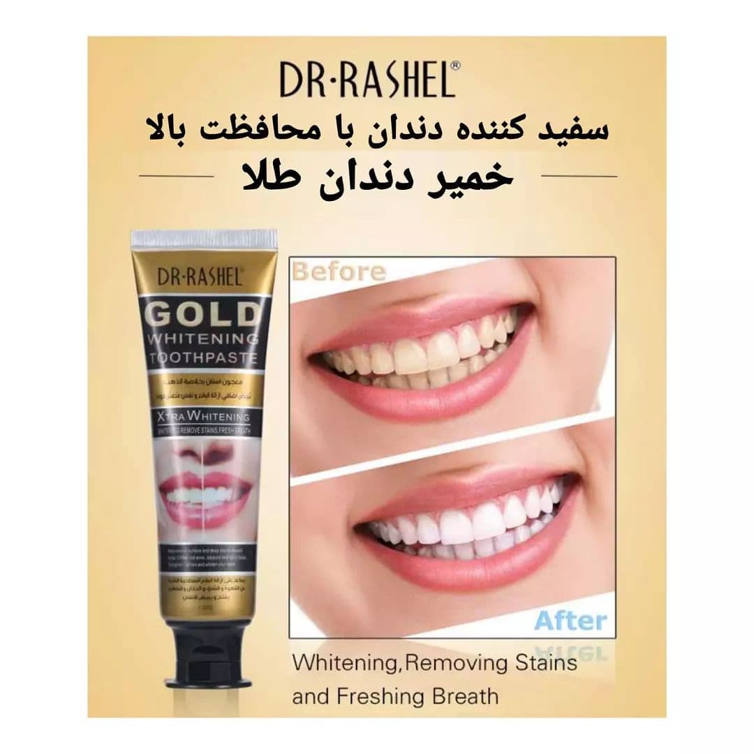خمیر دندان سفیدکننده طلا دکتر راشل اصل ۱۲۰ گرم | Dr.Rashel Gold Whitening Toothpaste — تصویر ۹