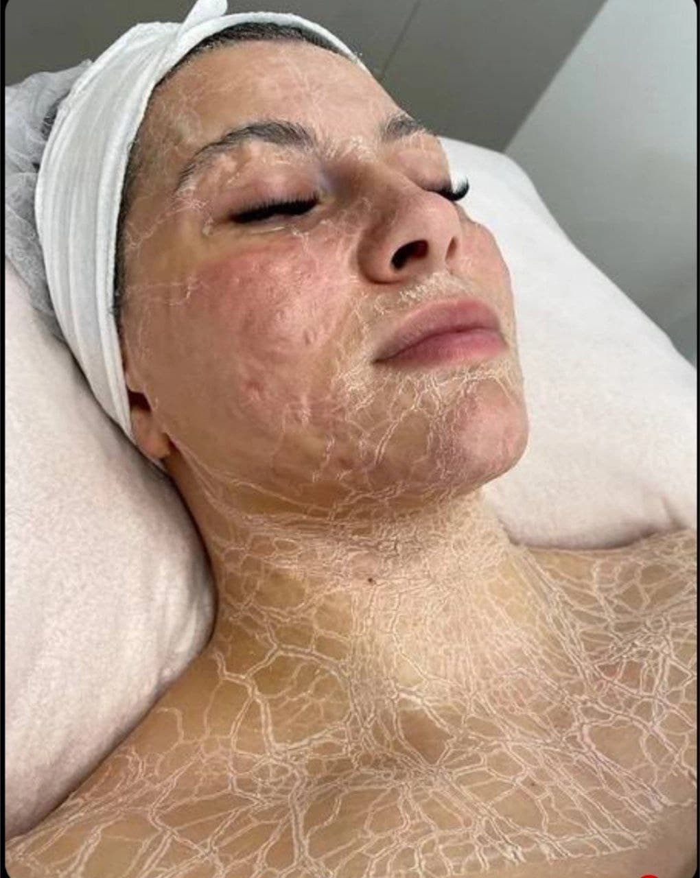 دیپ آنزیم سلاوی — تصویر ۱۲