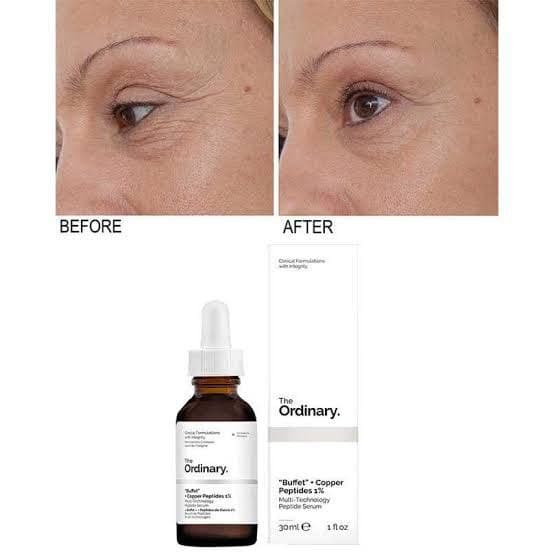 سرم مولتی پپتاید کوپر اوردینری | The Ordinary Multi-Peptide + Copper Peptide 1% Solution — تصویر ۱۲