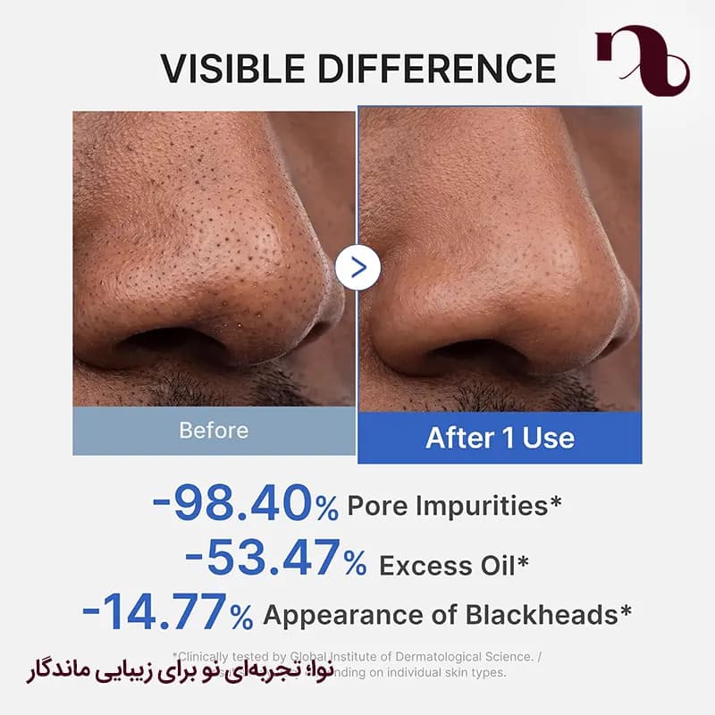 ماسک لایه بردار آبی مدی کیوب — تصویر ۱۲