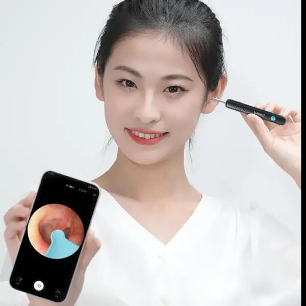 گوش پاک کن هوشمند شیائومی Bebird R1 — تصویر ۱۱