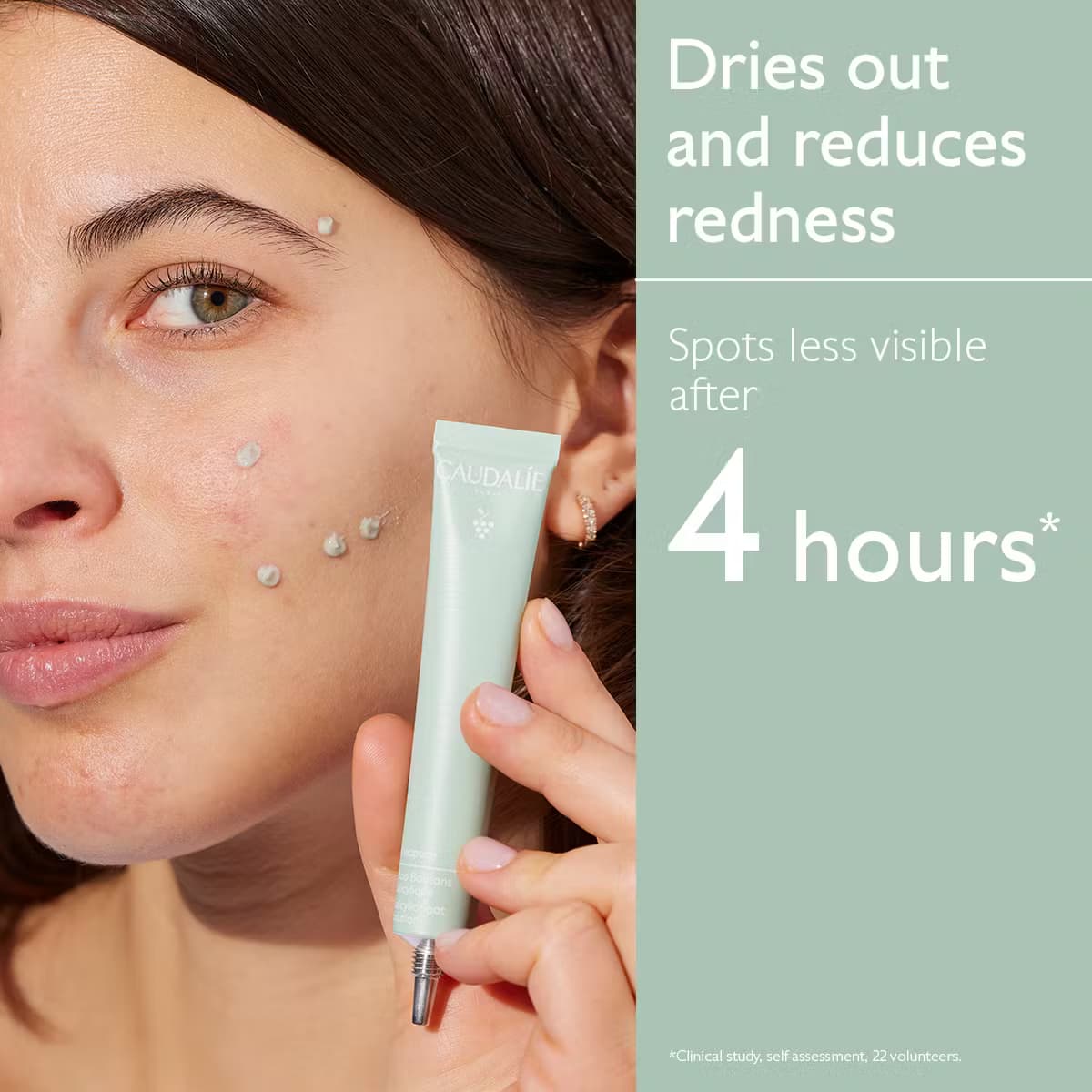 کرم ضدجوش فوری کدلی سری VinoPure مدل Salicylic Spot Solution حجم 15 میل — تصویر ۸