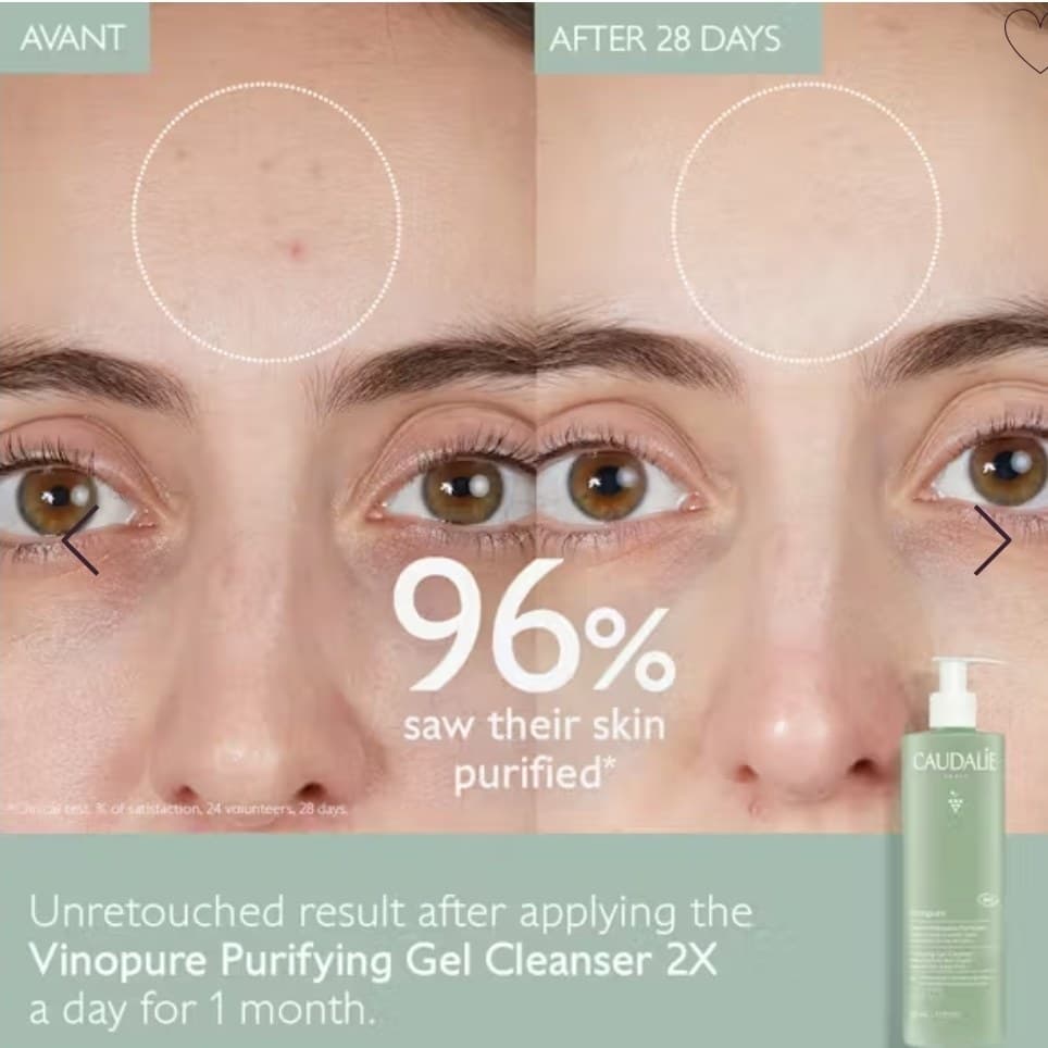 ژل شستشوی صورت کدلی مدل VinoPure مناسب پوست چرب و مستعد آکنه حجم 30 میل — تصویر ۳