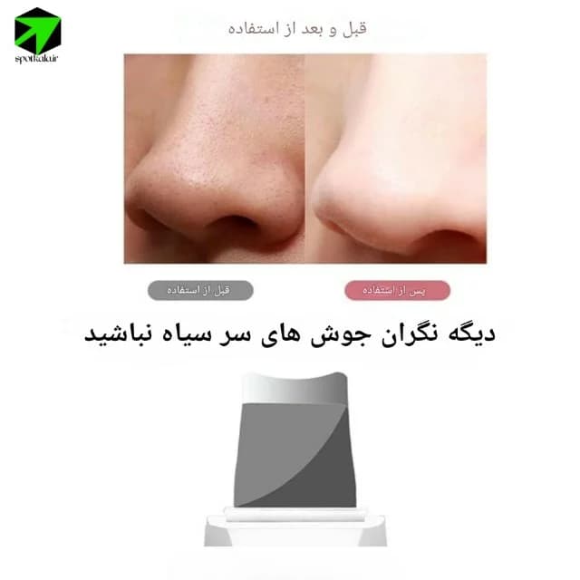 اتو صورت |Shovel Skin — تصویر ۴