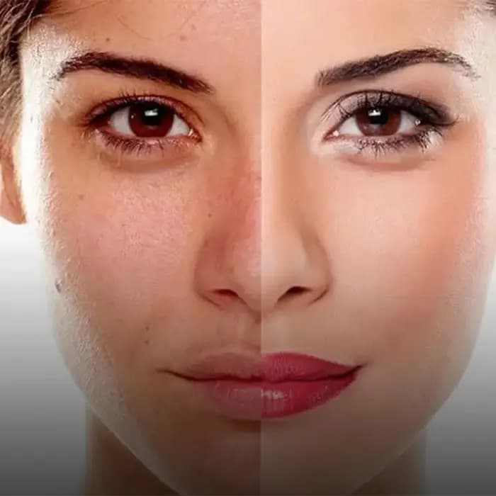 مرطوب كننده بر پايه آب آنتى باكتريال تنورا 100 میل — تصویر ۵