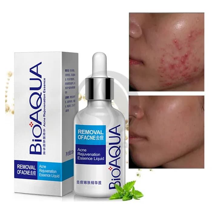 سرم ضد جوش بیوآکوا ا Bioaqua Anti-Acne Serum — تصویر ۷