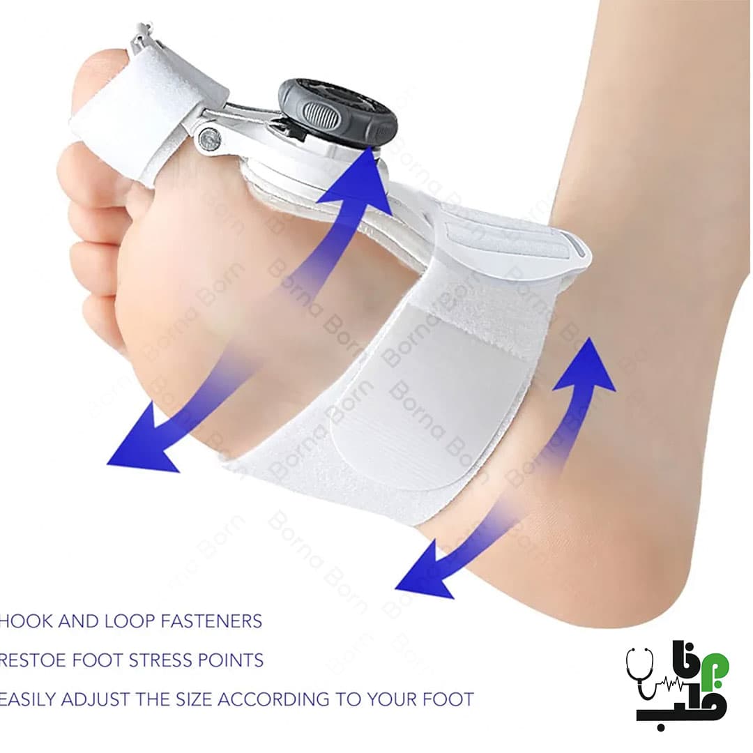 پد هالوکس والگوس درجه دار قابل تنظیم BUNION CORRECTOR — تصویر ۱۲
