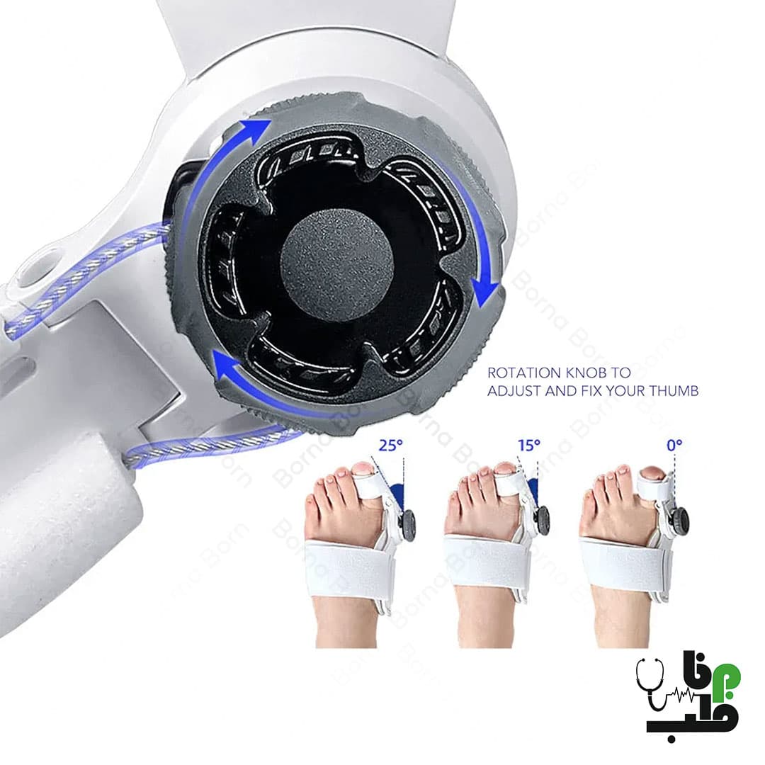 پد هالوکس والگوس درجه دار قابل تنظیم BUNION CORRECTOR — تصویر ۵