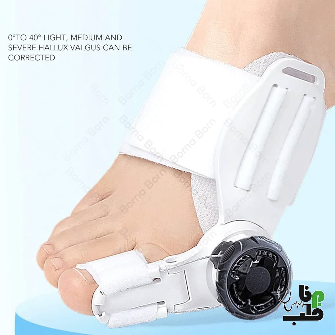 پد هالوکس والگوس درجه دار قابل تنظیم BUNION CORRECTOR
