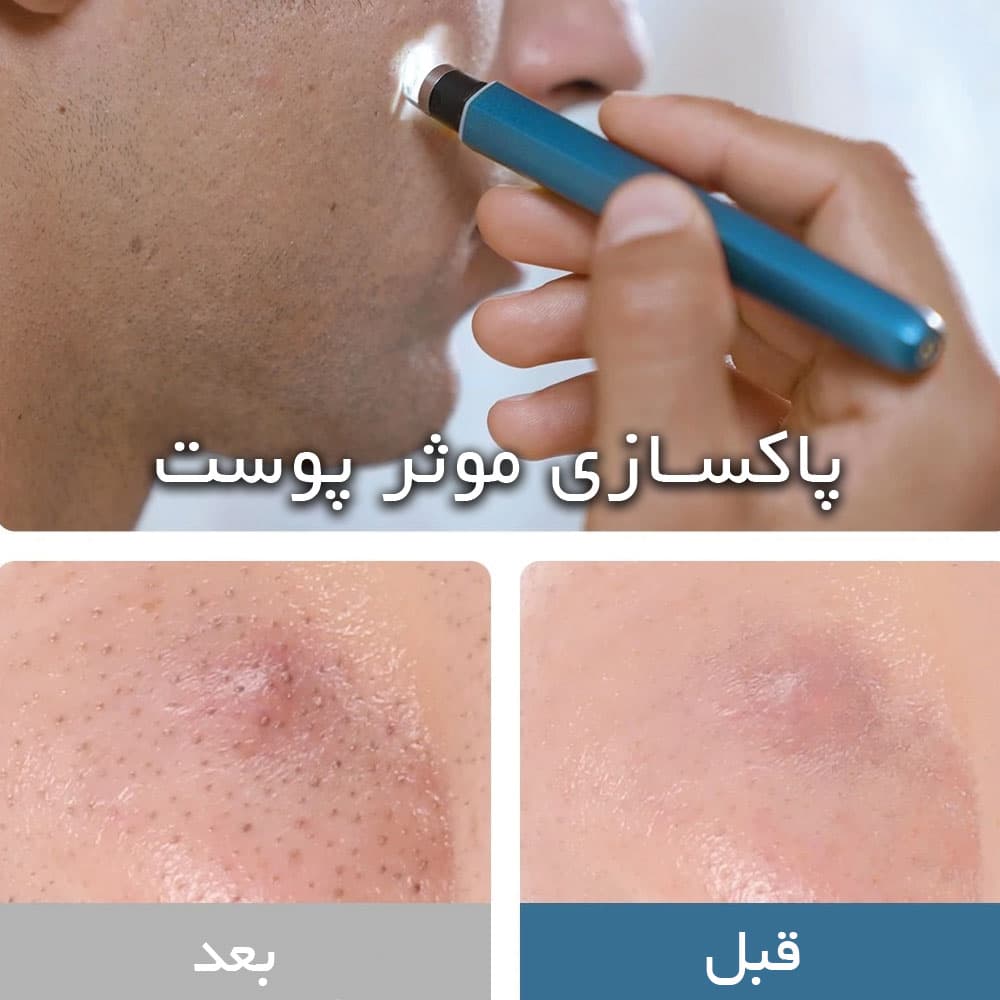دستگاه پاک کننده صورت Wisdom WiFi Smart Pore Cleaner شیائومی — تصویر ۹