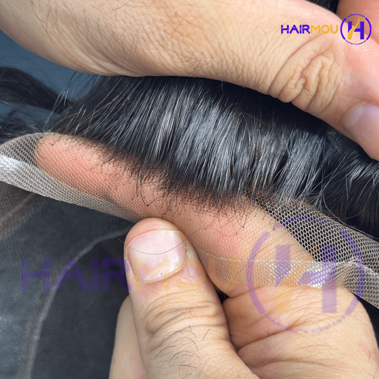 پروتز مو آنکارایی | درجه 1 – ساخت کره — تصویر ۱۰