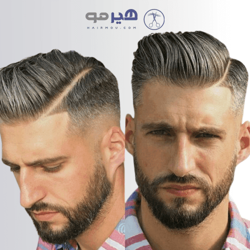 پروتز مو آنکارایی جوگندمی | مردانه VIP