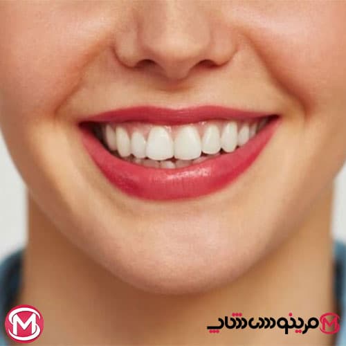 خمیردندان سفید کننده سیگنال مدل white system حجم 75 میل — تصویر ۸