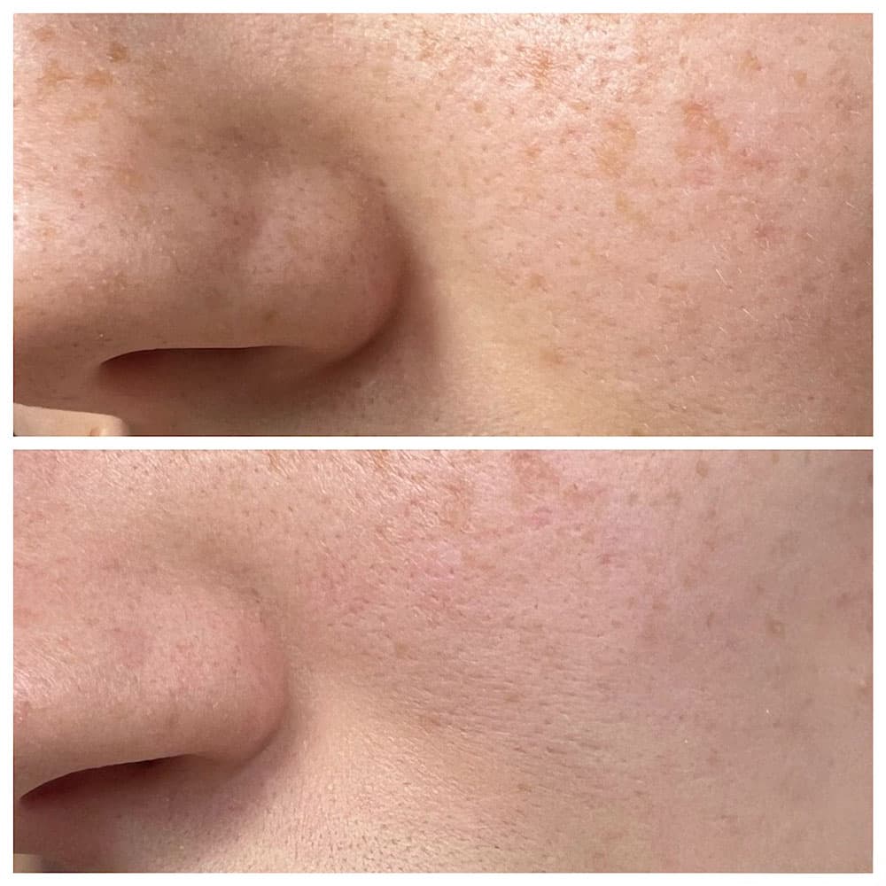 تونر ضد جوش سر سیاه و کنترل منافذ منیو فکتوری Manyo Factory Blackhead & Pore Toner — تصویر ۵