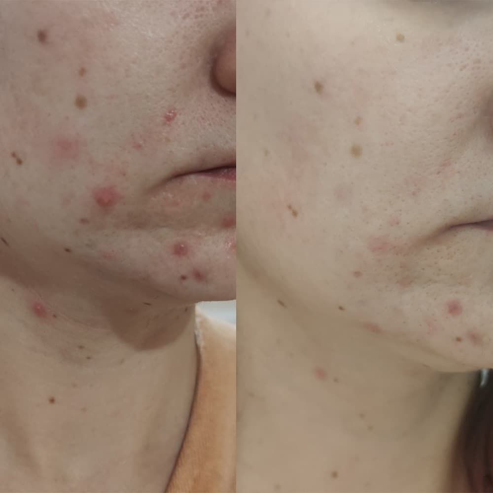 تونر ضد لک و روشن کننده 30 روزه یوجا نیاسین سام بای می Some By Mi Yuja Niacin Miracle Brightening Toner — تصویر ۶