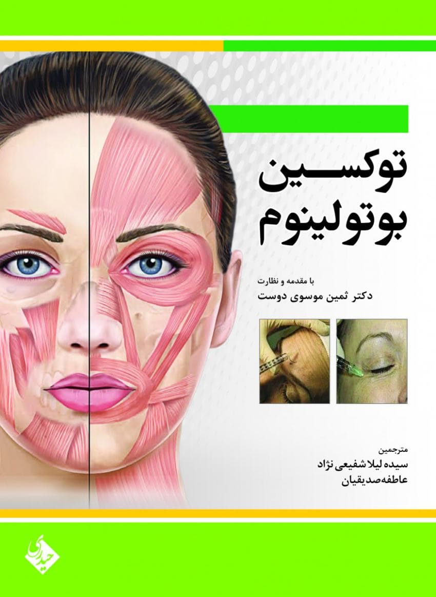 توکسین بوتولینوم — تصویر ۳