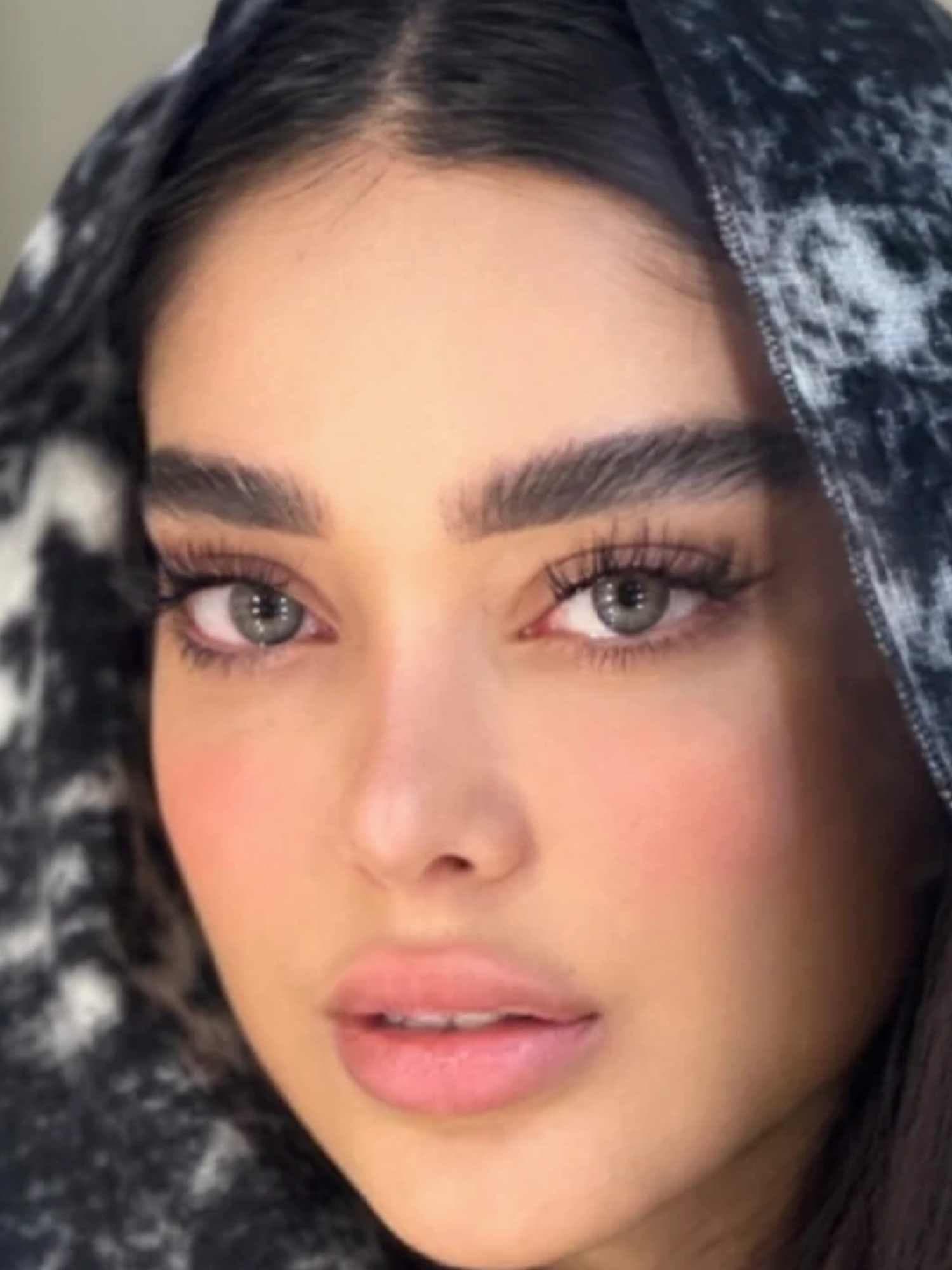 لنز طبی رنگی رز آلیس گری Alice Gray