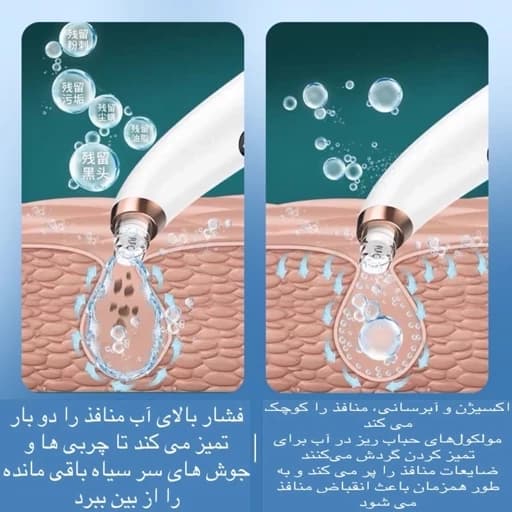 دستگاه میکرودرم لایه بردار و پاکسازی پوست — تصویر ۵