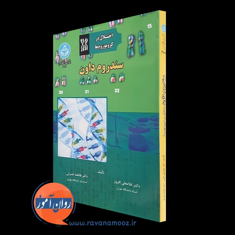 سندروم داون (اختلال در کروموزوم ها) – غلامعلی افروز