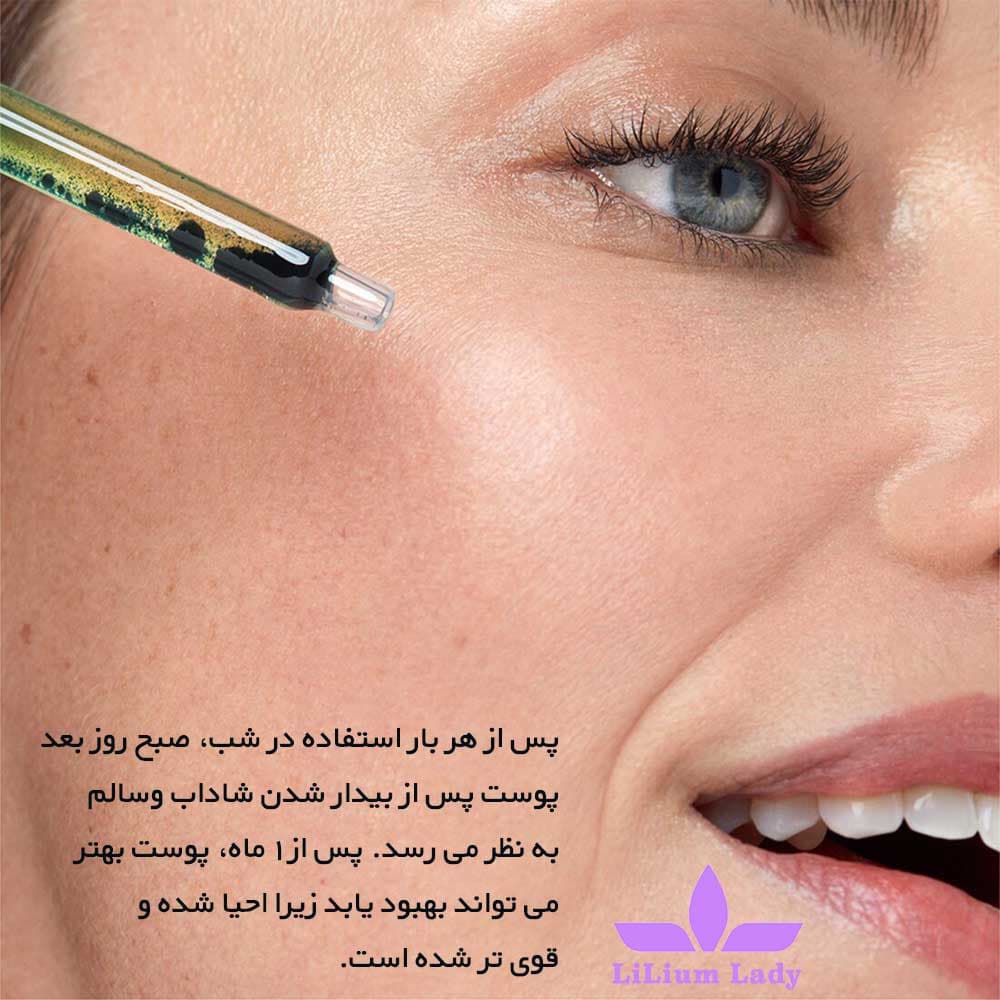 سرم ترمیم کننده شب با اثر ملاتونین ایوروشه — تصویر ۸