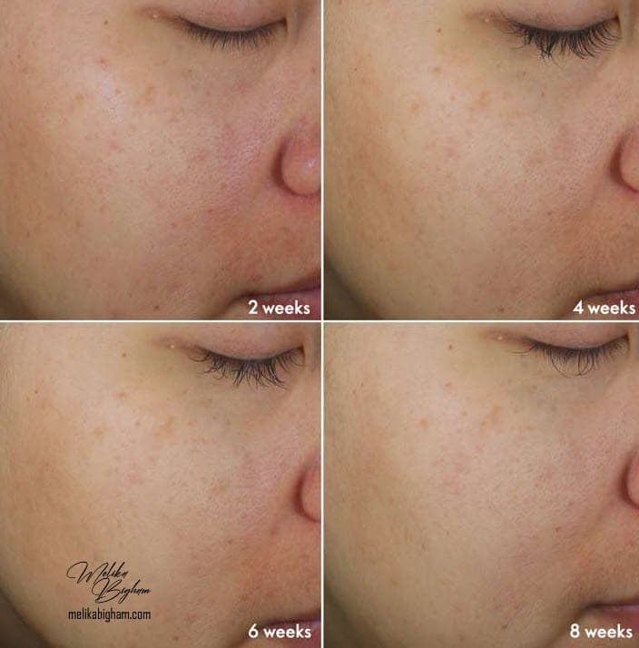 پک روشن کننده و ضدلک نوایج پلاس اوریفلیم Novage+ Bright Intense Routine Mixed — تصویر ۸