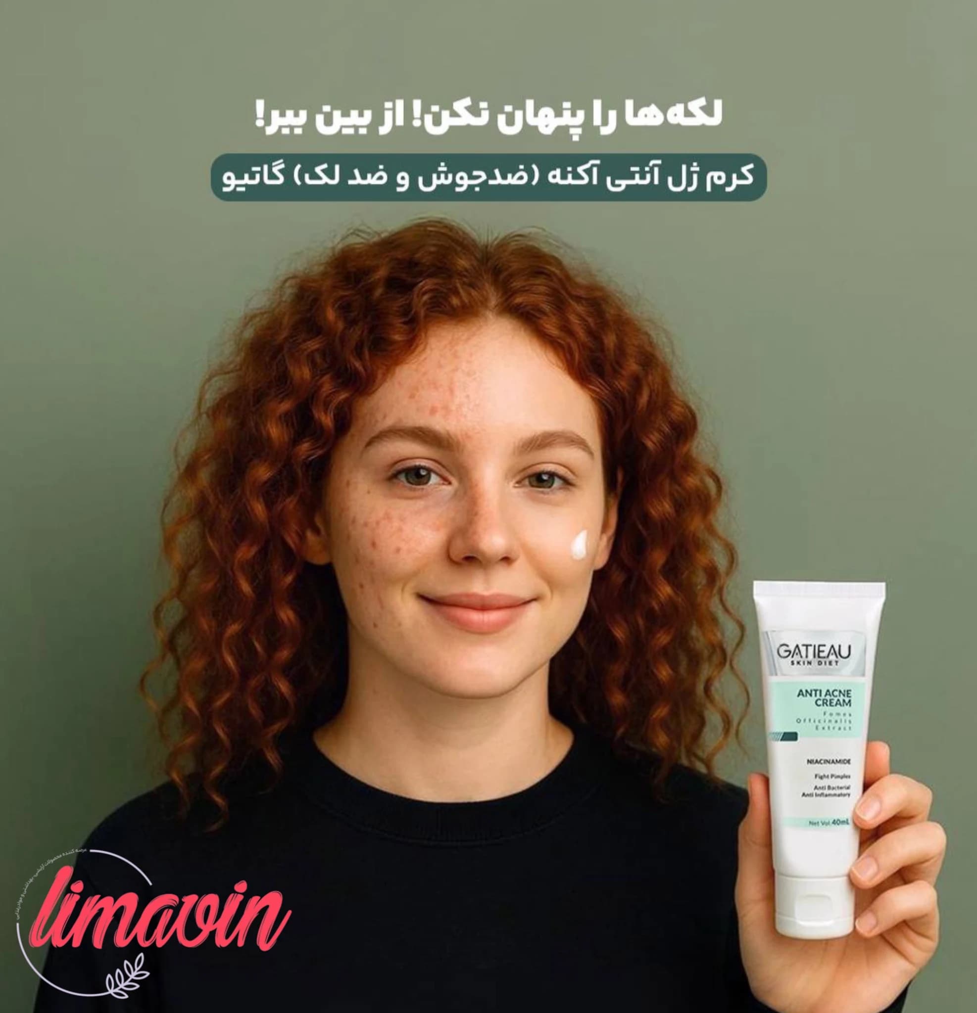 کرم نوروژن گاتیو مدل ضدلک و ضدجوش حجم ۴۰ میلی لیتر — تصویر ۱۱