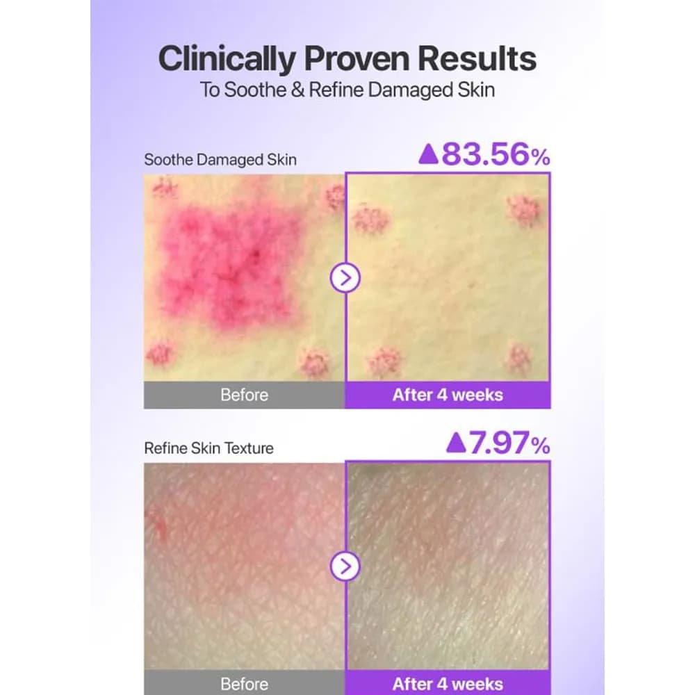 ضدافتاب جوانساز و ضدچروک 9پپتید و NAD نامبوزین numbuzin +9 & NAD SUN SCREEN — تصویر ۴