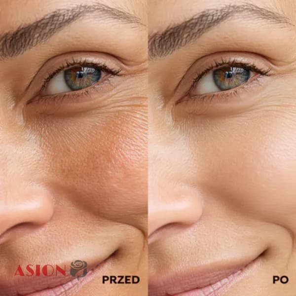 کرم ضد چروک و تیرگی دور چشم و دور لب میکرونیدلینگ کریستین لورنت — تصویر ۵
