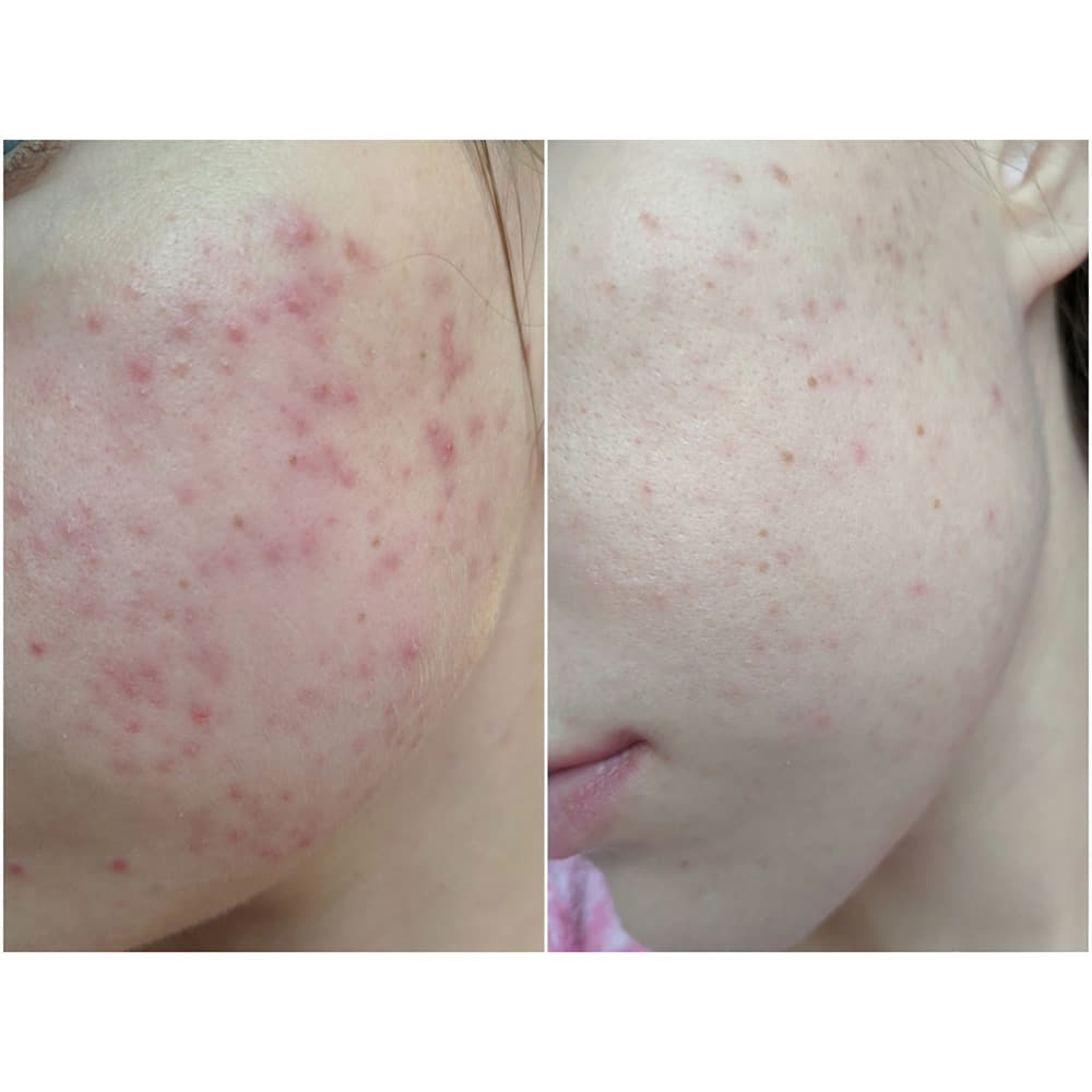 اسنس ضد التهاب و قرمزی ماگورت آیم فرام I’m From Mugwort Essence — تصویر ۶