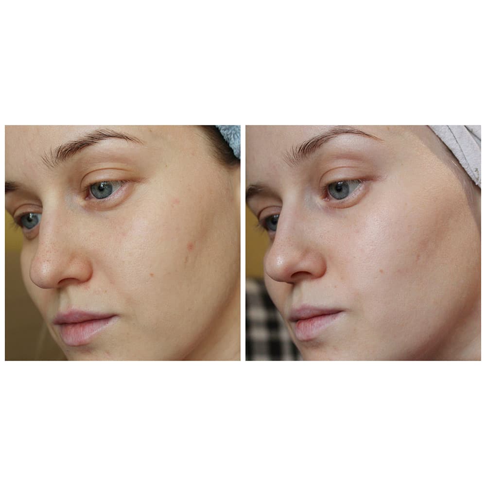 تونر ضد لک و روشن کننده ویتا سی پلاس میشا Missha Vita C Plus Brightening Toner 200ml — تصویر ۶
