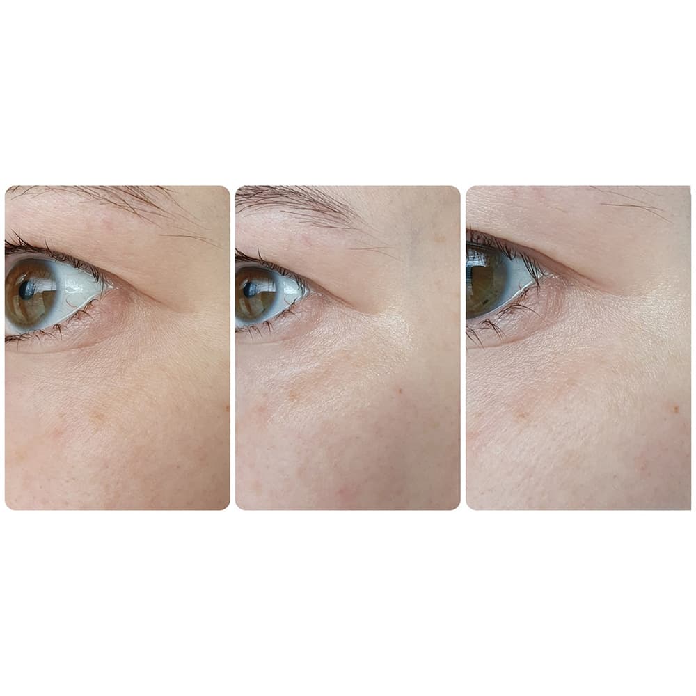 سرم ضد چروک و روشن کننده دور چشم رولی سرامید فارم استی Farm Stay Ceramide Wrinkle Care Relaxing Rolling Eye Serum 25ml — تصویر ۸