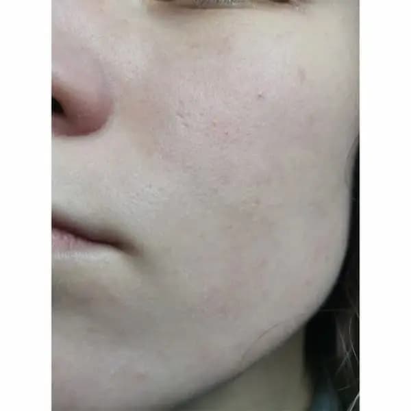 ضد آفتاب مینرال تروسیکا سام بای می Some By Mi Truecica Mineral Calming Tone-Up Suncream 50ml — تصویر ۱۲