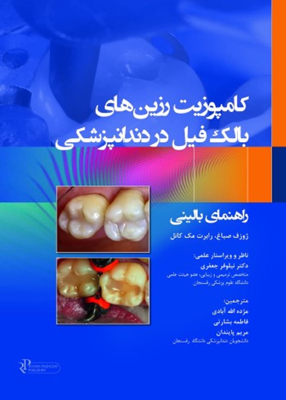 کامپوزیت رزین های بالک فیل در دندانپزشکی 2023 راهنمای بالینی — تصویر ۳