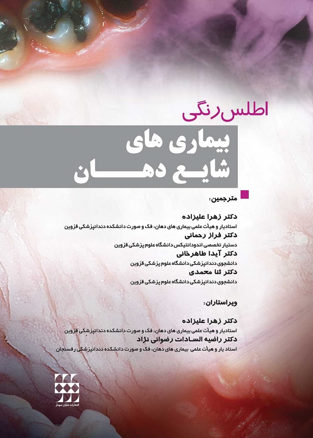 اطلس رنگی بیماری های شایع دهان — تصویر ۳