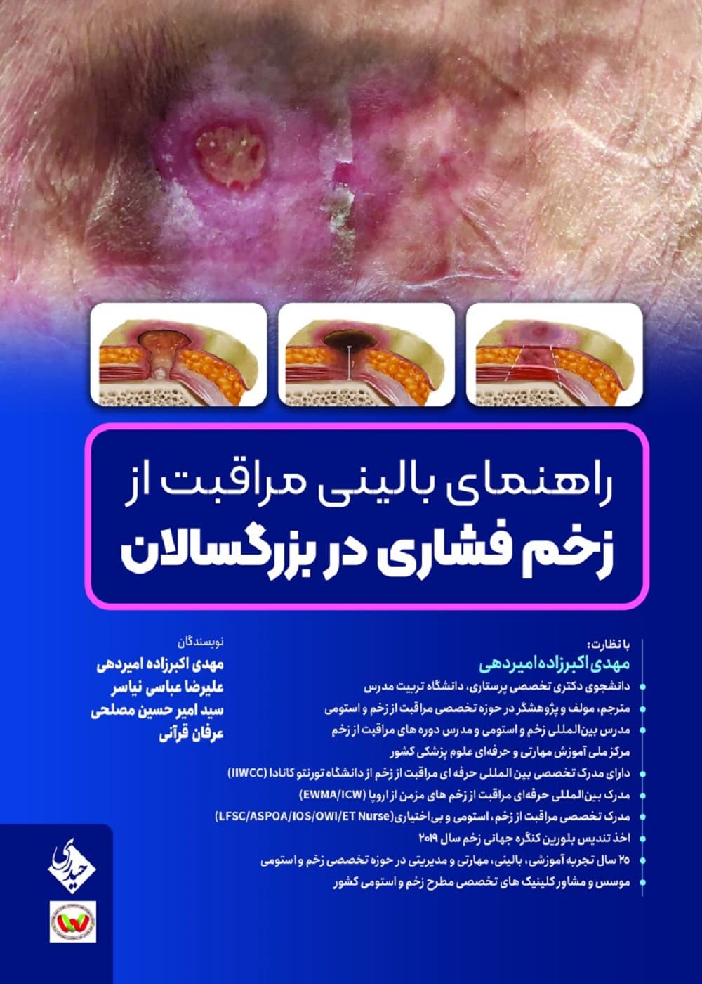 راهنمای بالینی مراقبت از زخم فشاری در بزرگسالان — تصویر ۲
