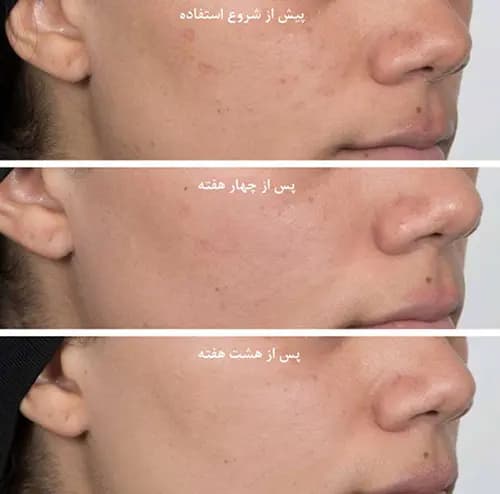 تونر نیاسینامید استلین Estelin (روشن کننده و ضد لک) — تصویر ۱۱