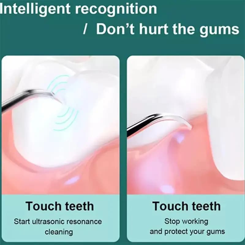 جرم گیر دندان هوشمند شیائومی مدل Xiaomi Sunuo Intelligent Visual Ultrasonic Dental Scaler T12 Plus — تصویر ۱۲