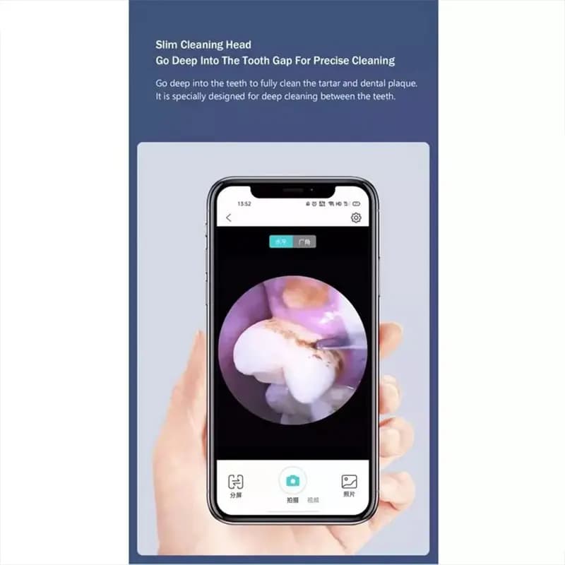 جرم گیر دندان هوشمند شیائومی مدل Xiaomi Sunuo Intelligent Visual Ultrasonic Dental Scaler T12 Plus — تصویر ۹