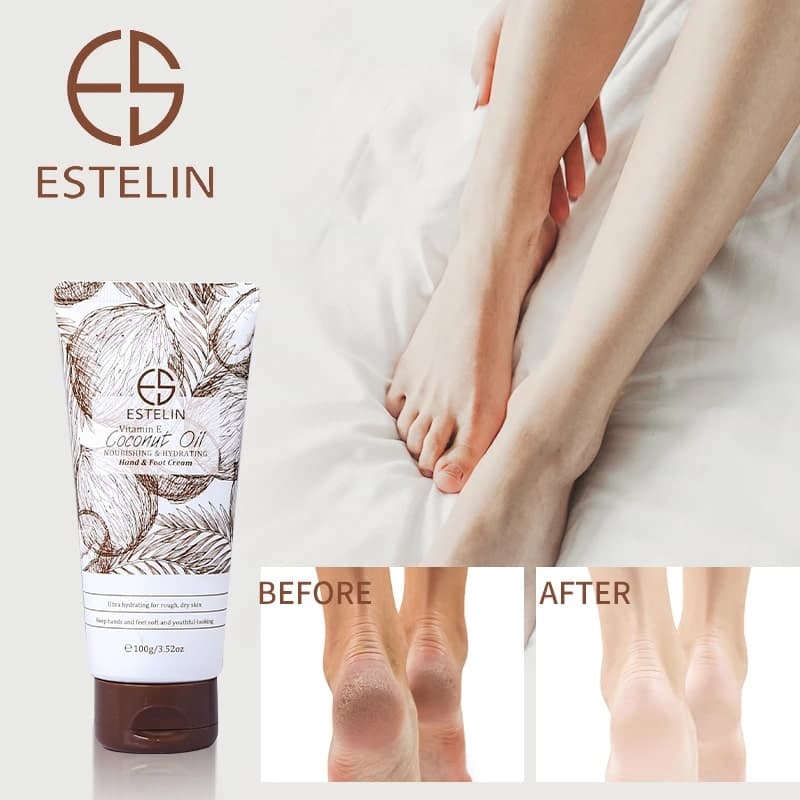 کرم دست و پا نارگیل و ویتامین E استلین ESTELIN Coconut Oil Hand & Foot Cream — تصویر ۳