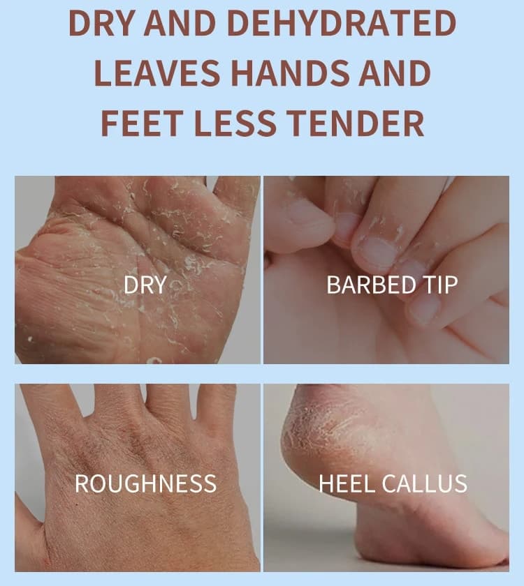 کرم دست و پا نارگیل و ویتامین E استلین ESTELIN Coconut Oil Hand & Foot Cream — تصویر ۵