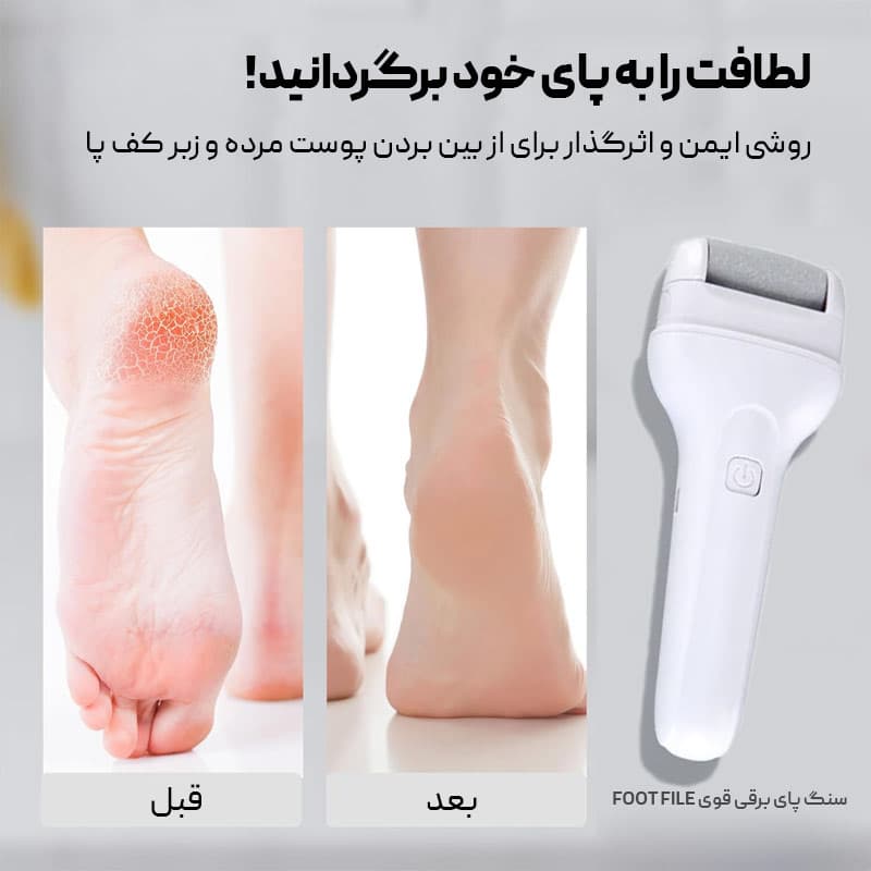 سنگ پای برقی(شارژی) قوی مدل FOOT FILE VELVET — تصویر ۱۱