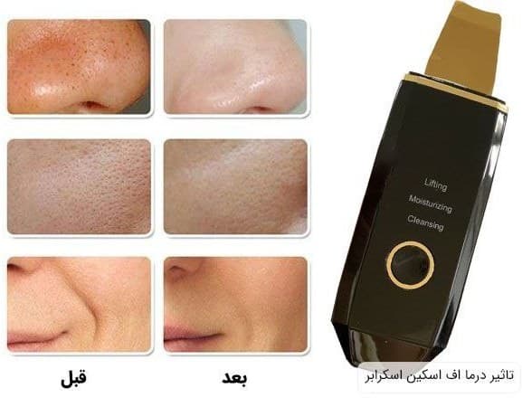 اتوی صورت یا درما اف الین تیغه گلد SKIN SCRUBBER — تصویر ۶