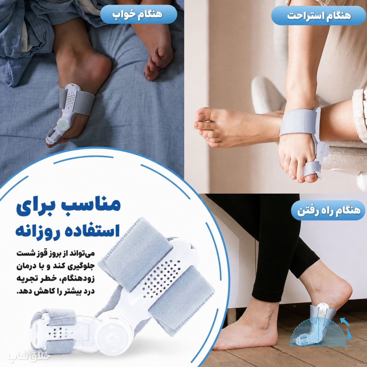 اصلاح انحراف شست پا-آتل انگشت پا درمان هالوکس والگوس — تصویر ۱۱
